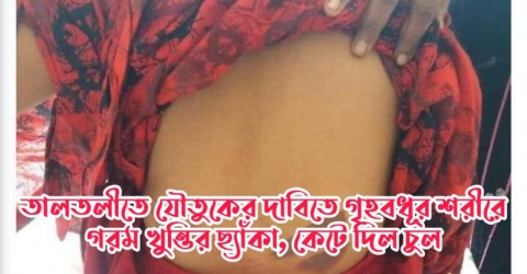 তালতলীতে যৌতুকের দাবিতে গৃহবধূর শরীরে গরম খুন্তির ছ্যাঁকা, কেটে দিল চুল